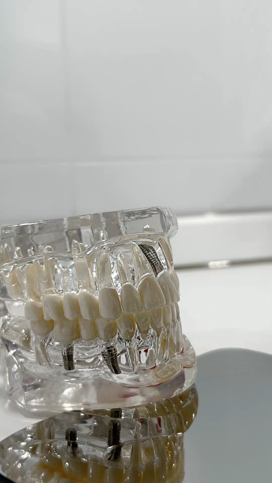 Имплантация